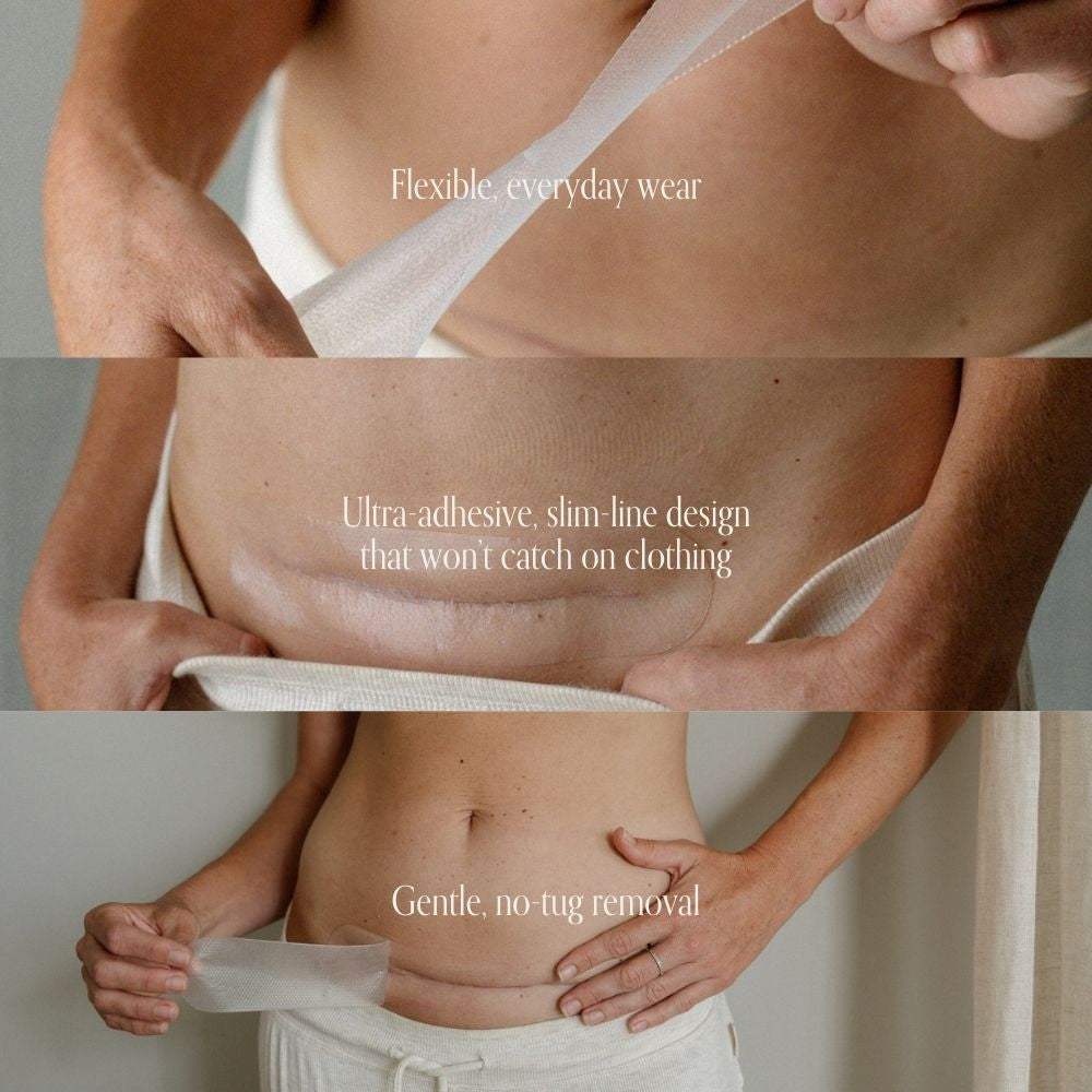 C-Section Scar Care Kit