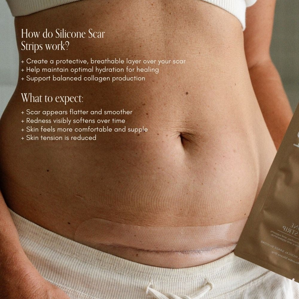 C-Section Scar Care Kit