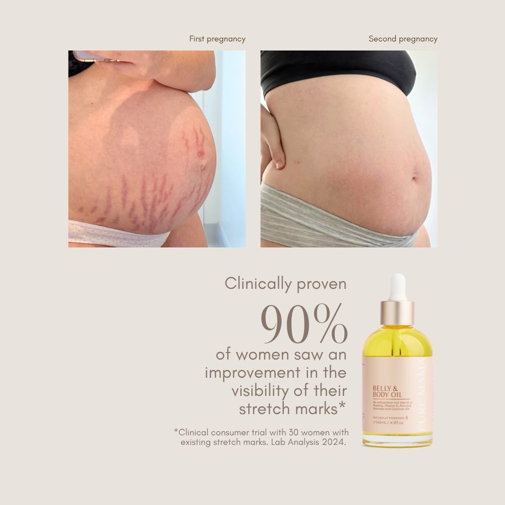 Side-by-side photos show a pregnant belly with red stretch marks (left) and reduced marks (right), plus Pure Mama NZ Belly & Body Oil and text: 90% of women saw improved skin elasticity and reduced stretch mark visibility.