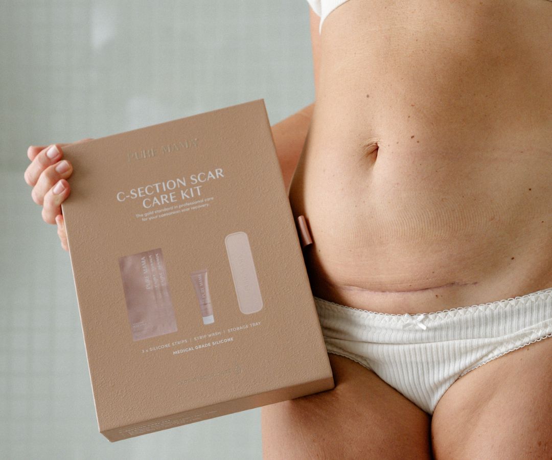 Understanding the four phases of c-section scar recovery