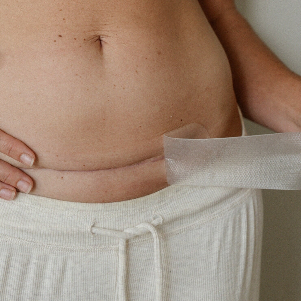 C-Section Scar Care Kit