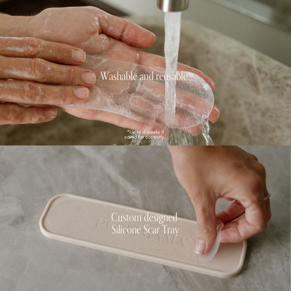 C-Section Scar Care Kit