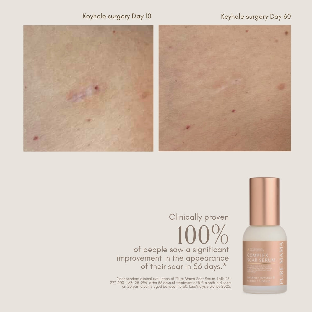 NEW Complex Scar Serum