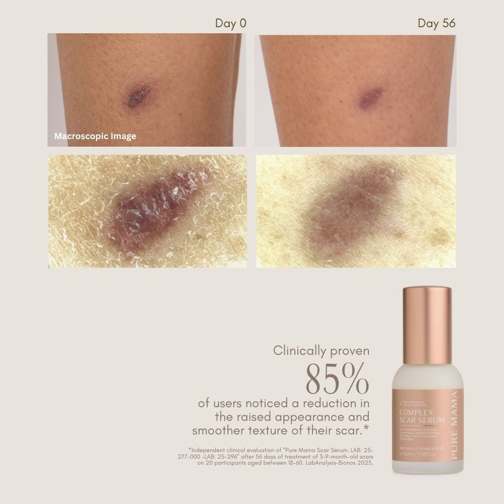 NEW Complex Scar Serum