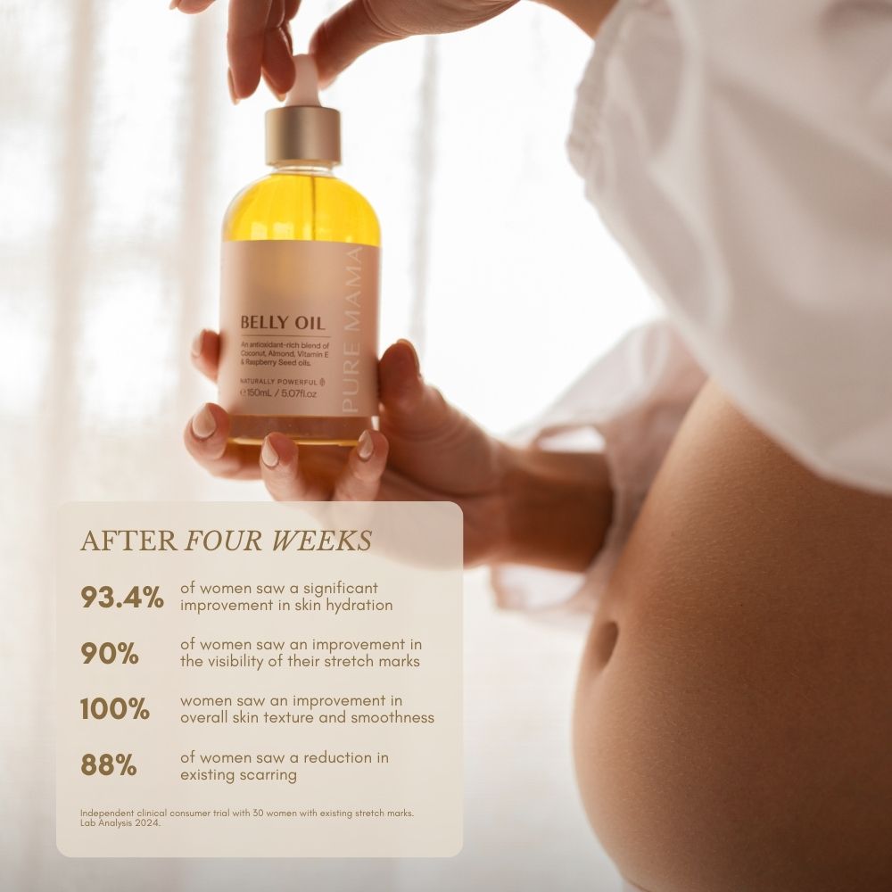 A close-up of a pregnant person holding the Pure Mama NZ Bump Love Set near their bare belly. Overlay text highlights four weeks of stretch mark prevention, improved hydration, and reduced scarring results.