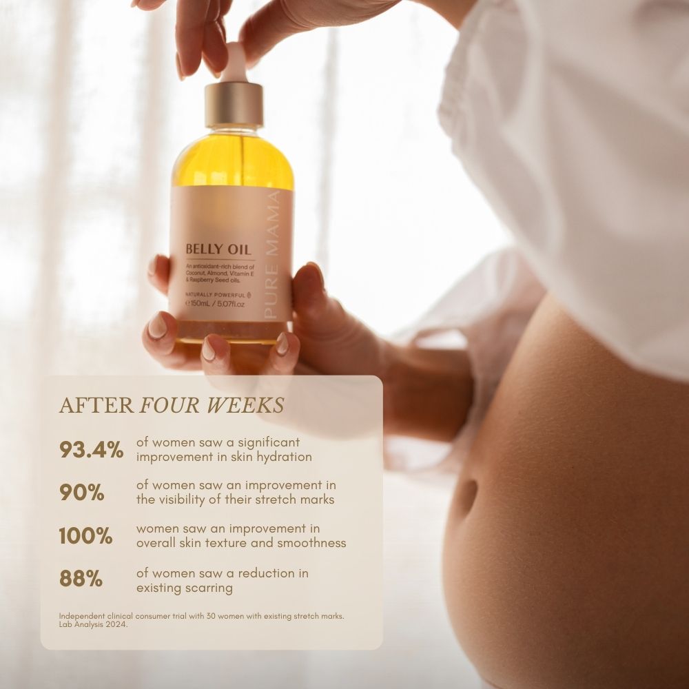 A pregnant woman holds Pure Mama NZ’s Stretch Mark Belly Oil. Overlaid text highlights improved hydration, smoother skin, better elasticity, reduced scarring, and fewer visible stretch marks after four weeks of use.