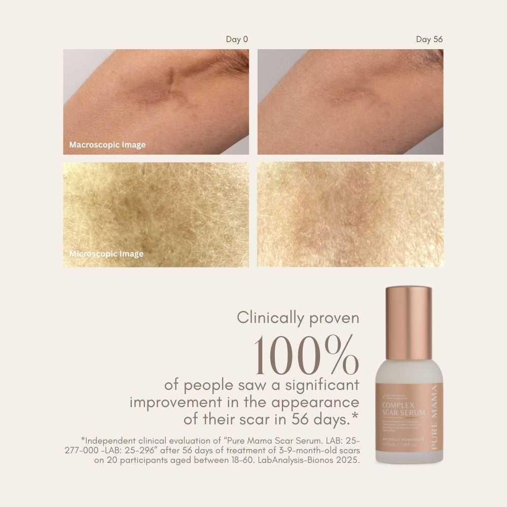 NEW Complex Scar Serum