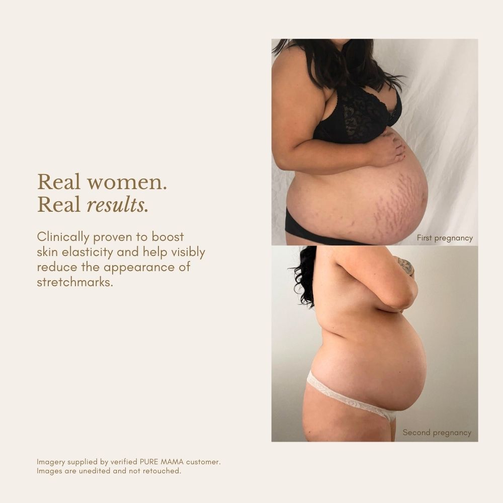 Pregnancy Care Set