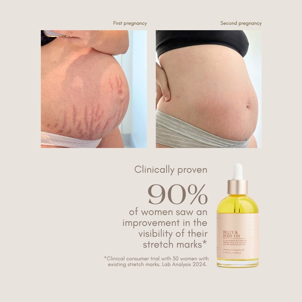 Two side-by-side photos show a pregnant belly: one with visible stretch marks, the other with fewer. Below is a bottle of Pure Mama NZ Stretch Mark Belly Oil and text stating “90% of women saw improvement in stretch mark visibility.”.