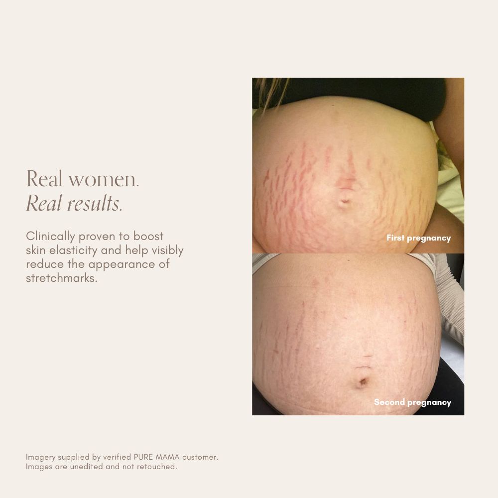 Bump Love Set