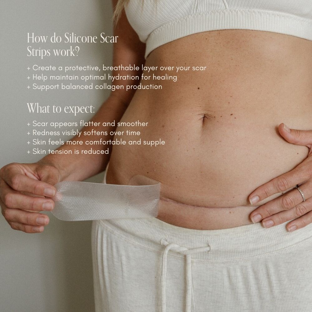 NEW Silicone Scar Strip